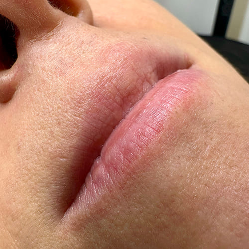 ktr-brows-tratamiento-hydra-lips-madrid-07